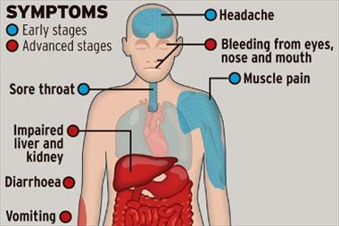 /zonadigital/el-ebola-es-persistente/32754.html